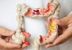 Bệnh lý về hệ tiêu hoá thường gặp và cách phòng tránh