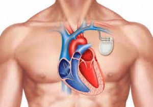 Thông báo về việc mời chào giá các mặt hàng thiết bị y tế  sử dụng trong kỹ thuật đặt máy tạo nhịp tim năm 2025-2026 tại Bệnh viện Đa khoa khu vực miền núi phía Bắc Quảng Nam